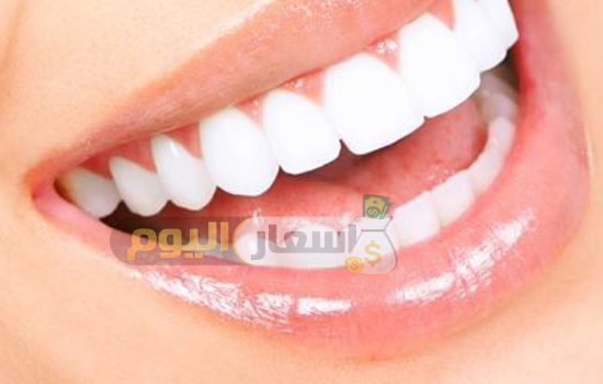 Photo of أسعار زراعة الأسنان 2024 اخر تحديث